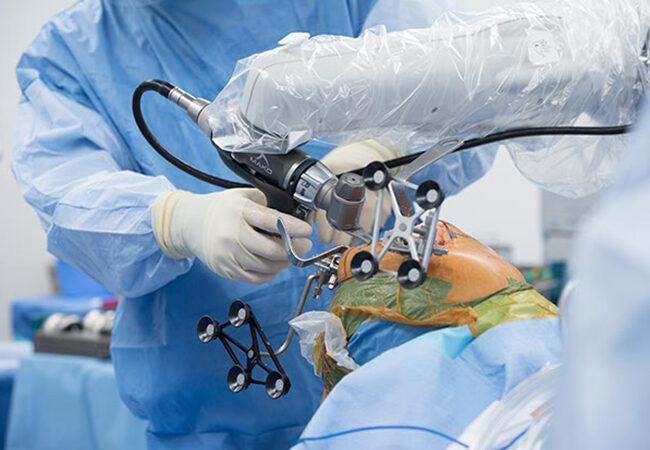 Robotic Total Knee Replacement in India